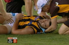 Ouch! Maybe International Rules isn't such a good idea