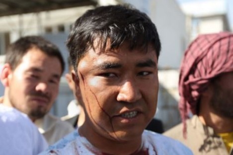 An injured man in interviewed by journalists after an explosion struck a protest in Kabul.