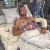 Irishman 'burnt to the bone' after sleeping bag caught fire at Australian rodeo