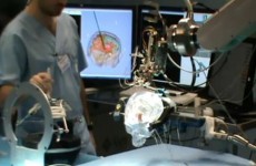 EU-funded Researchers Make Breakthrough On Robotic Brain Surgery