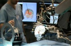 EU-funded researchers make breakthrough on robotic brain surgery