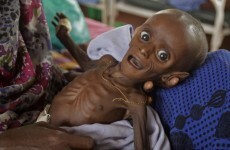 Somali militants ban 16 aid groups and UN agencies
