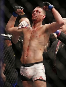 How Diaz forced McGregor to change the approach that brought him to the top