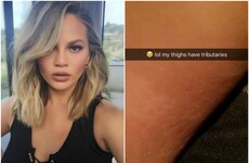 Women are loving Chrissy Teigen showing off her stretch marks on Snapchat