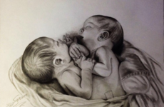 Conjoined twins born in the midst of battle in Syria have died while awaiting permission to travel
