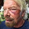 Billionaire Richard Branson thought he was going to die after falling off his bike