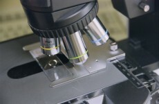 Cervical cancer screening programme leads to 100 diagnoses