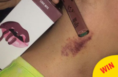 This girl compared her new Kylie Lip Kit to a hickey to see if it lived up to its name