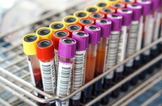 Trinity study seeks women exposed to Hepatitis C-contaminated product in 70s