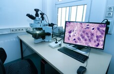 Plans for new cancer institute at St James' Hospital