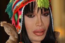 Singer Pete Burns has died, aged 57