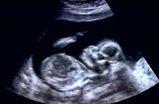 Government will not block opposition bill on rogue crisis pregnancy agencies