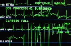 Ireland's vital signs: The nation's health over the last decade