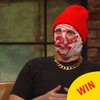 Blindboy from The Rubberbandits introduced the concept of gas c*ntism to the Late Late
