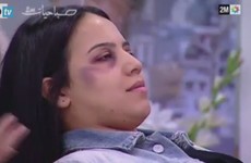 Moroccan state TV broadcasts makeup advice for women for disguising evidence of domestic violence