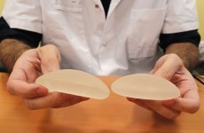 Concern that Irish women could be affected by faulty breast implants