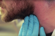 Irish scientists mix silly putty with graphene to create ultra-sensitive health sensors