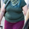 Gastric bypass surgery helps obese teens keep weight off but can lead to more surgery