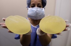 Faulty breast implants lead to €60 million payout to 20,000 women