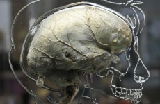 Brain power begins to decline from age 45 - study