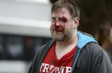 Photos: At least 20 people arrested after clashes as hundreds rally in support of Trump