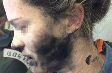 Woman's face is burned after battery-operated headphones catch fire on airplane