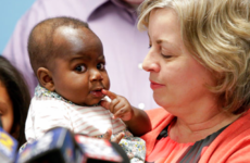 Baby born with four legs and two spines recovering well after surgery