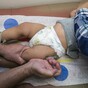 Europe-wide measles warning as outbreaks of disease spread across a number of nations
