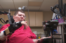 Groundbreaking science allows paralysed man use his brain to control his arms again