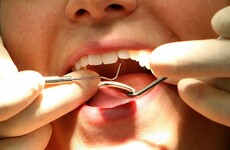 If you're self-employed, your PRSI will soon entitle you to a free teeth clean