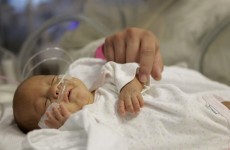 US hospital prepares to send tiny baby home