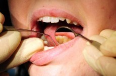 HSE underspent on dental care by €11.5m last year