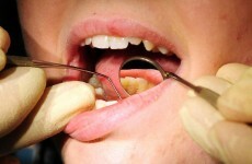 HSE underspent on dental care by €11.5m last year