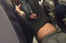 United row passenger lost two front teeth, had a broken nose and concussion