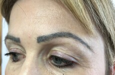 Warning about poorly trained eyebrow technicians leaving clients with scars
