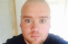 'I thought it was a hangover, but it was more sinister' - Cork man diagnosed with brain tumour at 25