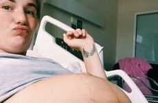 People are loving this blogger's explanation of why a Caesarean section is *not* the easy way out