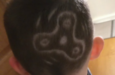 A 6-year-old Irish lad actually got a fidget spinner shaved onto his head