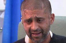 'If this was a white person .. It'd be all over the news': Muslim acid attack victim speaks out