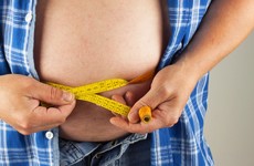 Ireland is carrying out less than one weight loss surgery a week