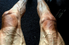 This is what 16 gruelling stages of the Tour de France will do to your legs