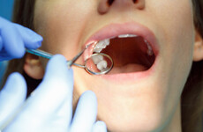 There has been a big drop in people getting HSE-funded dental treatments