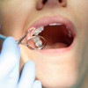There has been a big drop in people getting HSE-funded dental treatments