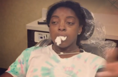 Simone Biles shared a hilarious video of what happened to her after she got her wisdom teeth removed