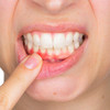 Women with history of gum disease at higher risk of cancer, study says