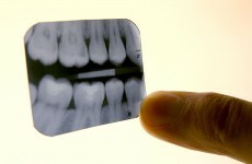Dental sector could face loss of up to 1,000 jobs this year