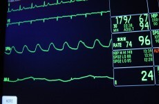 Heart attack misdiagnosis doctor guilty of poor performance