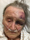 'It simply beggars belief': 88-year-old woman brutally attacked in her own home in Lancashire