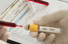Sitdown Sunday: DNA ancestry tests can reveal your family's long-kept secrets