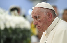Pope Francis has a black eye after falling in his popemobile